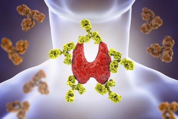 甲状腺癌|甲状腺癌是‘吃’出来的?医生:常吃3物,铁打的甲状腺也扛不住