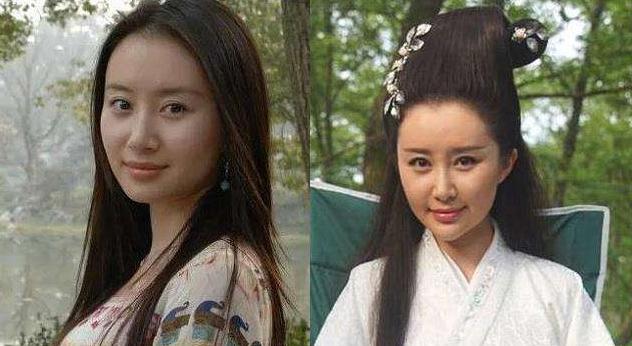 整容|初见惊为天人，再见脸僵如石！这10位女星的脸，到底怎么了