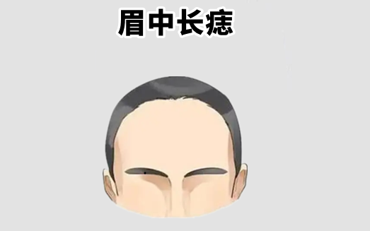 中国易经风水|“千金难买5颗痣”，一个聚财，一个添福，福泽子孙几代人！
