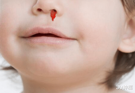 39肿瘤 肝病的发物是“鸡蛋”？肝科医生：真想养肝，马上停止食用“1种调料”