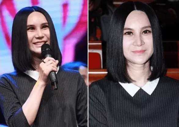 整容|整容失败的10位明星，谁堪称“阴影”之最？