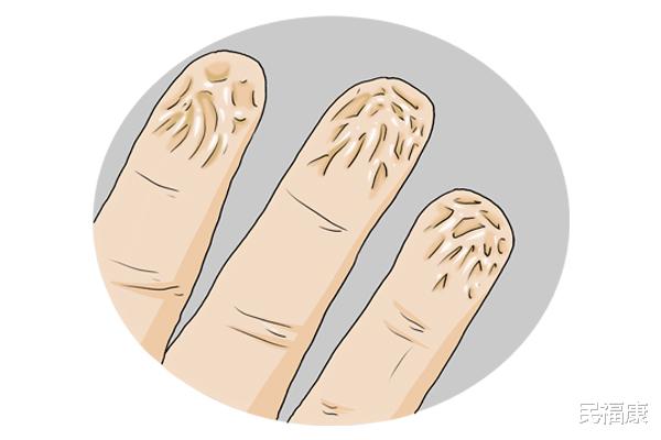 |为什么洗澡、游泳时间长了手指头会起皱？其他部位为什么没变化？
