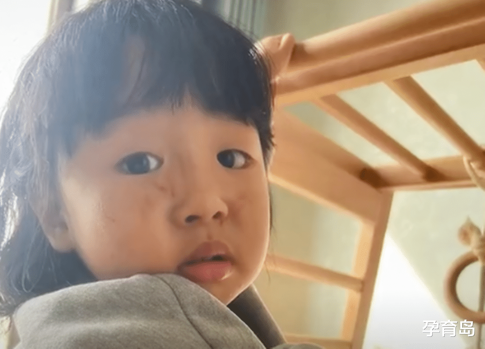 孕育岛|女儿被同伴抓得满脸花,爸爸难受得说不出来话,心疼之情溢出屏幕