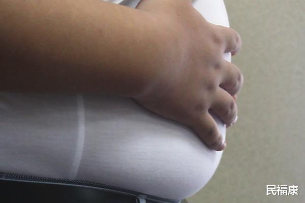 心脏|想预防心血管问题，记住8个饮食原则，4多4限，你做到了几条？