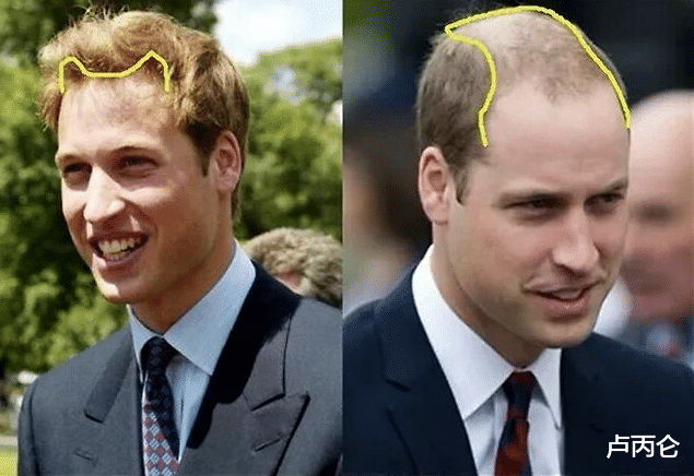 衰老|为什么有些人越长越好看，有的人越长越丑？