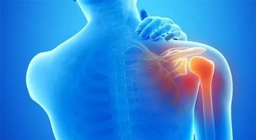 肩周炎|?天气冷了，越来越多的人患肩周炎。