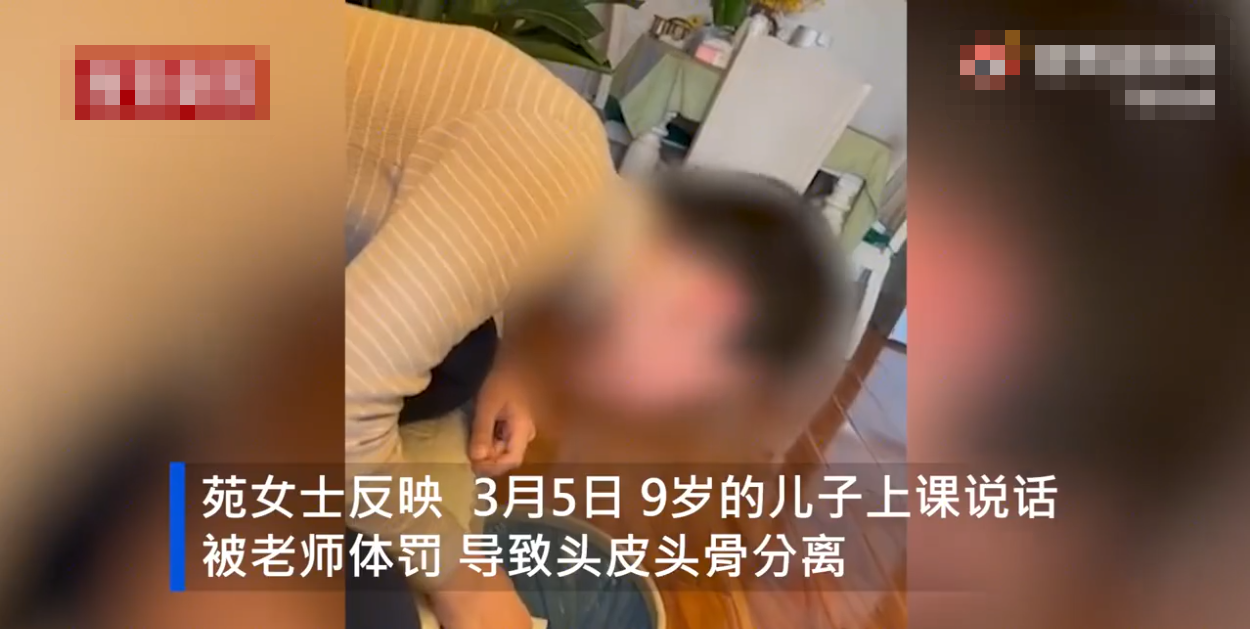 视野新闻周刊 河南9岁男童因上课讲话遭老师体罚，导致头皮头骨分离，校方：与学校无关