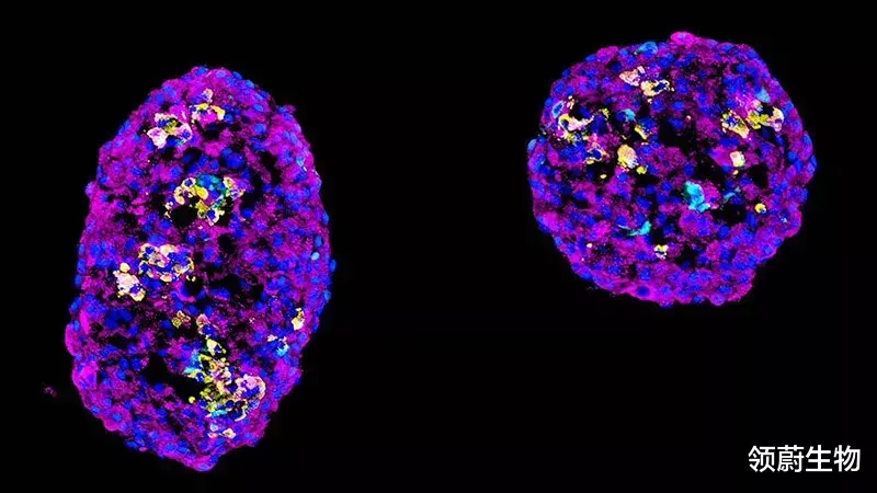 首例再生胰岛β细胞的背后:iPSc、10亿美元和不放弃的科学家父亲