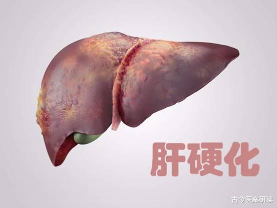 古今医案研读|25岁女子频繁乏力，查出肝硬化，医生提醒：爱喝的2水或是“罪魁祸首”