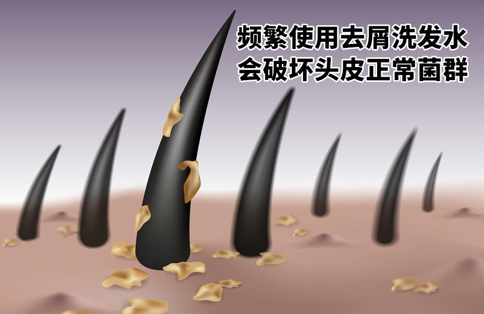 头发越来越差，快看看是不是你洗发水没用对？