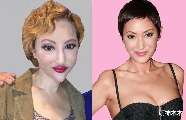 整容|变丑遭前男友嫌弃，为变美却断送前程，女星整容翻车实在太惨