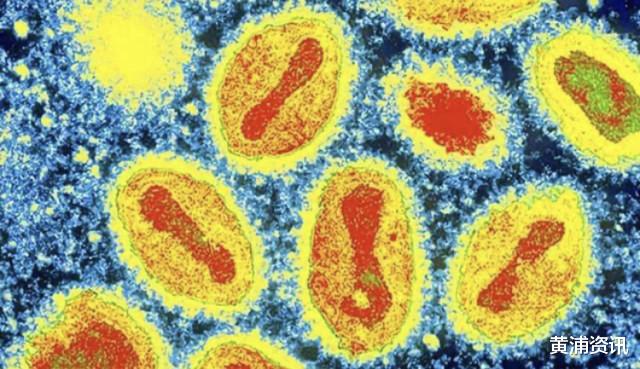 波兰|又一种病毒泄露！美国惊现天花病毒冷冻瓶，世卫曾多次要求销毁