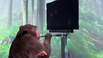 科学家 疯人院地下室科学家，最初的脑机接口实验，毫无人权可言！