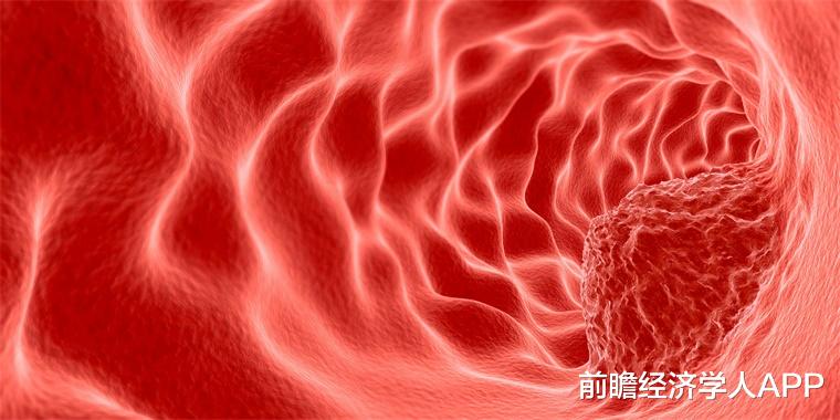 新型冠状肺炎 HIV病毒会直接导致淋巴瘤吗？研究表明：存在可能，但非常罕见
