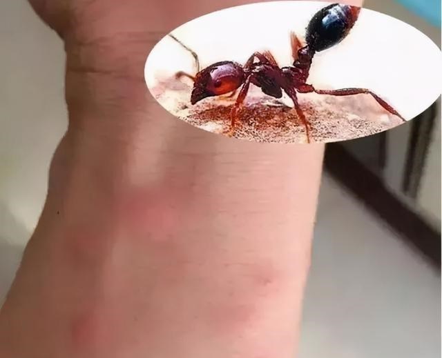 爱红烧肉|小暑日后养育孩子，家长牢记“三防”，让娃健康安然度过炎热夏天