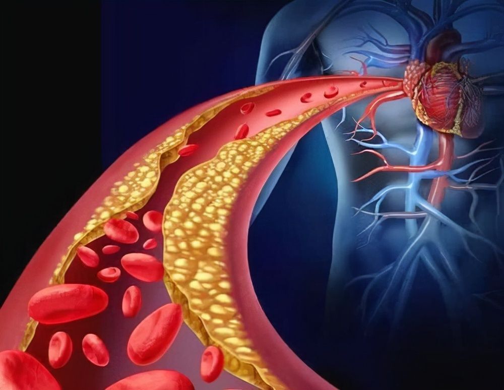 花生 花生能软化血管?了解花生的正确打开方式,还有助于美颜减肥