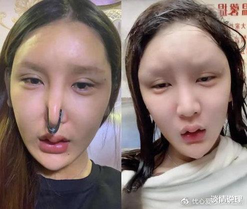 谈情说理|网红小冉抽脂手术被感染死亡：过度放纵欲望，会毁掉自己