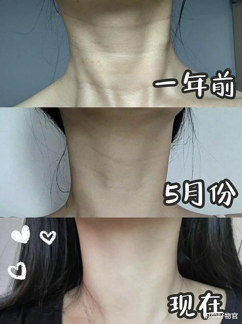 时尚好物官|那些坚持用美容仪的明星，皮肤都怎么样了？看完我也买了一个