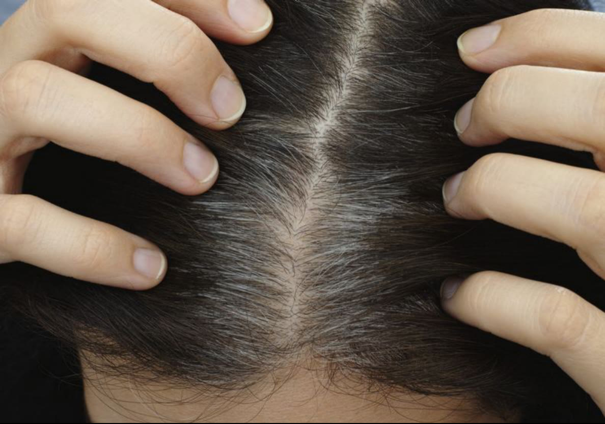 行星 一夜白发是真的！科学家强调：别忽略压力带来的可怕后遗症