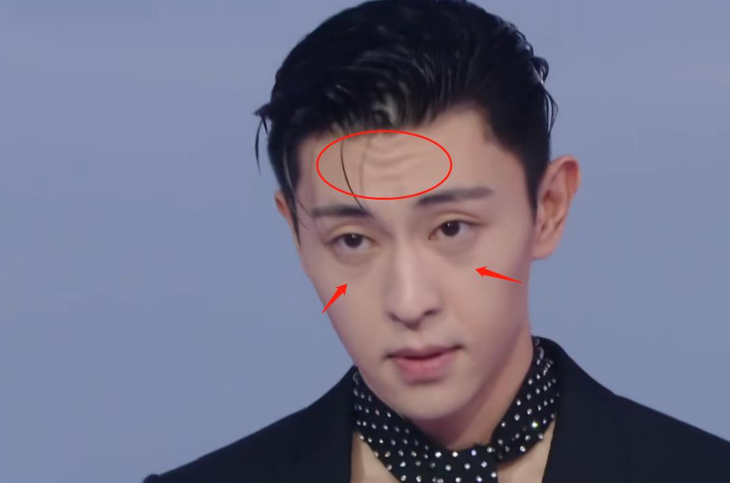 邓伦|男星红毯大赏：张若昀脖子前倾，邓伦大油头，白敬亭鼻头泛油光