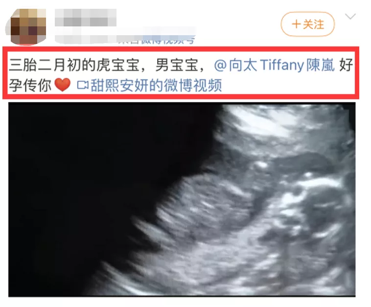 中超|34岁郭碧婷带女儿复出，放弃母乳喂养，而婆婆却在线接男宝