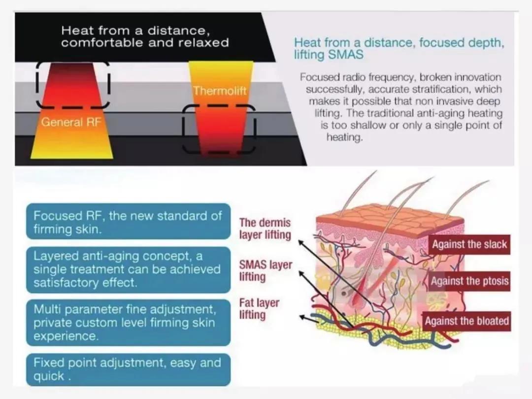 小美说美|热玛吉和热拉提哪个效果好