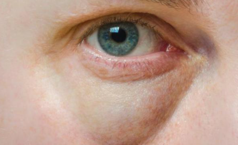 甲状腺疾病|为何甲状腺病越来越多？提醒：这3种食物尽早远离，别再贪吃