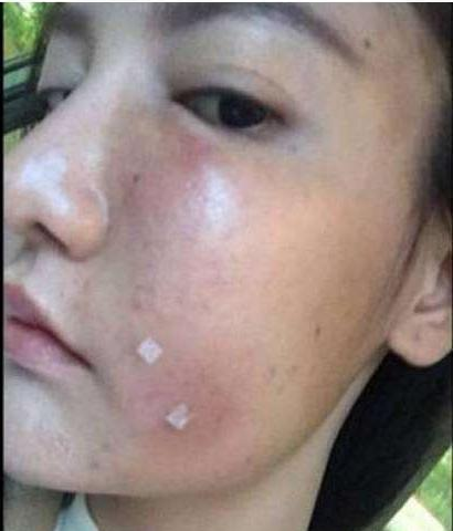 好物官|泰国打“美白针”的女人，整容9年只为“皮肤回春”，如今啥样了