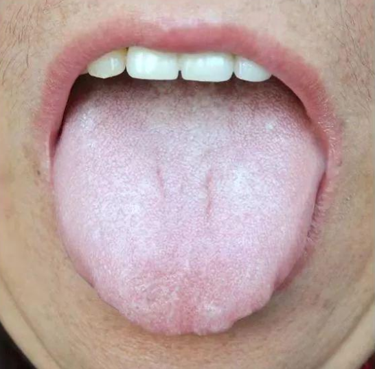 胸肌|怎么样才算是脾虚?脾虚到底是怎么回事?