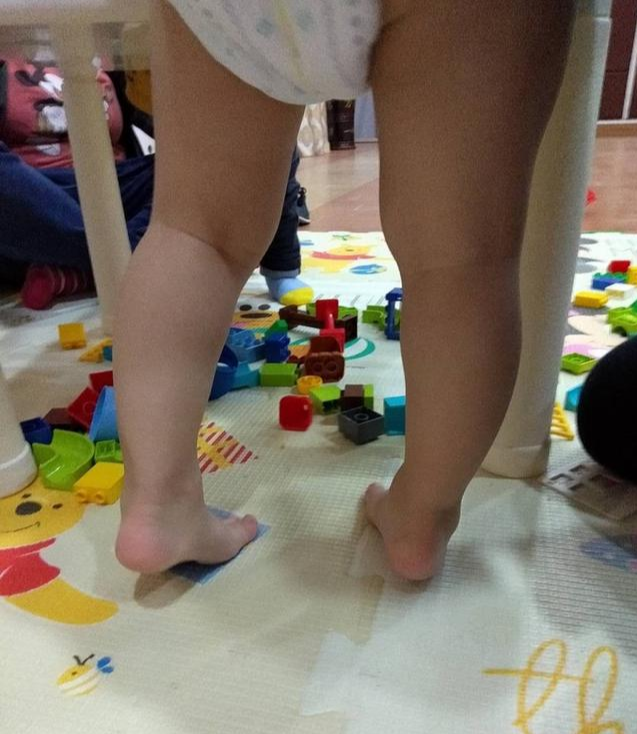 翟文利说育儿|一岁四个月的宝宝，喜欢踮脚走，正常吗？