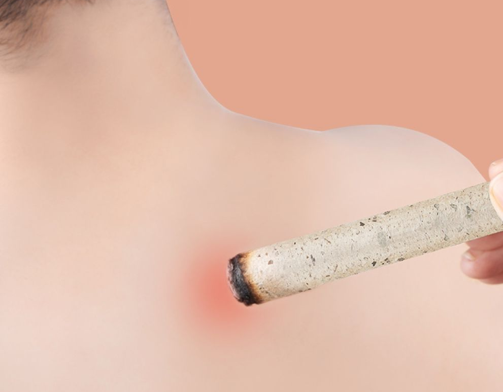 肉桂|寒露到了，秋凍正式開始！寒露艾灸正當時