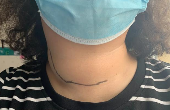 足力健|“散结神器”被发现，不是螺旋藻，你若爱吃，甲状腺如钢铁般强壮