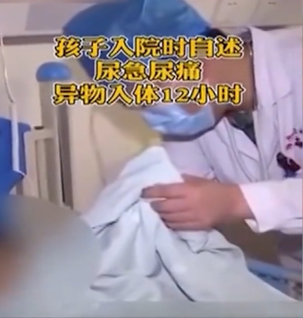 长三角观察 13岁男孩把异物塞进尿道,委屈说:想用磁力吸出来却越塞越多