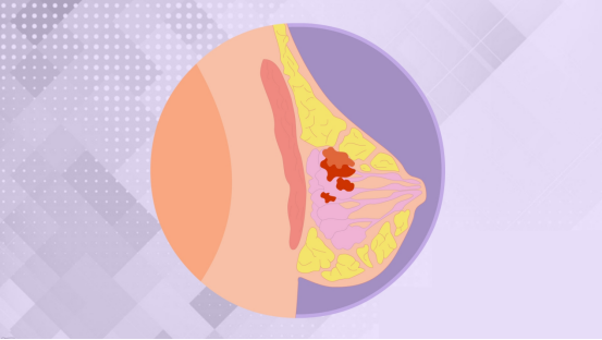 天天听健康|吃一次等于8斤蒲公英，妇科医生：女人不妨多吃，通乳散结，远离乳腺结节