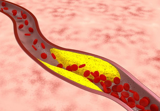胆固醇|“胆固醇大户”或被找到了，这4种食物，平时能少吃就少吃！