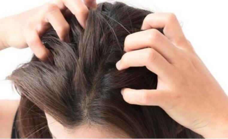 洗发水|头发刚打湿就抹洗发液？难怪出油旺盛又掉发，3个洗发步骤应谨记