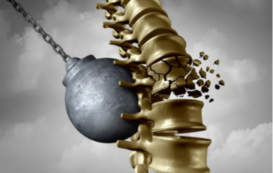 骨质疏松|80岁复旦骨科教授：骨质疏松患者必做的7件事，做一次相当于吃3瓶钙片