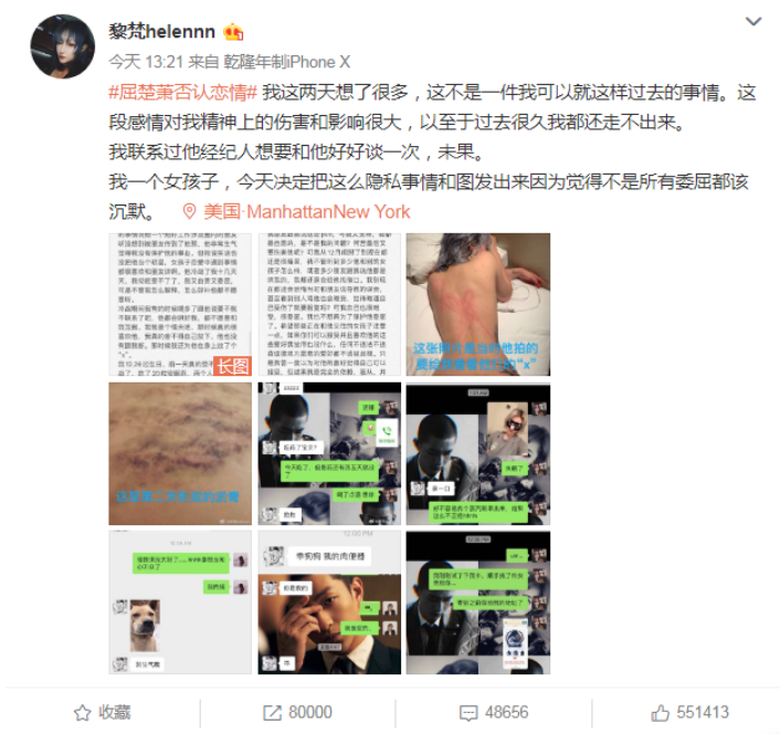 吴京|吴京亲手捧红的“白眼狼”，爆红后翻脸不认人，网友：报应来了！