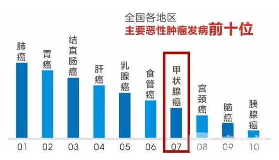 睡眠|甲状腺癌是“吃”出来的？提醒：睡觉若有4种表现，可能甲功已经很差了