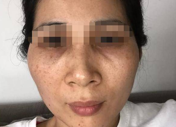 牛奶|每天喝牛奶可以淡斑吗?医生:真正美白的有2种食物,不妨常吃