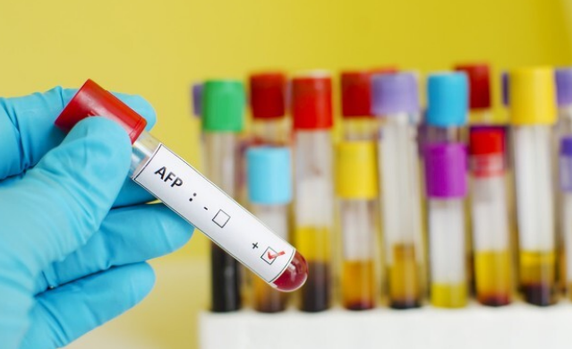 饮食|每天一个鸡蛋，28岁快递小哥确诊肝癌，医生：无知，吃一口等于十斤塑料