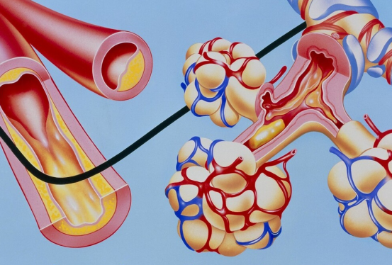 营养不良|玉米是高血脂的“发物”?医生:不想血管“瘫痪”,3种零食尽量少吃