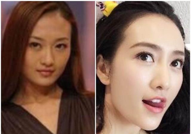 好物官|泰国连续打6年“美白针”的女子！如今怎么样了？网友：难以置信