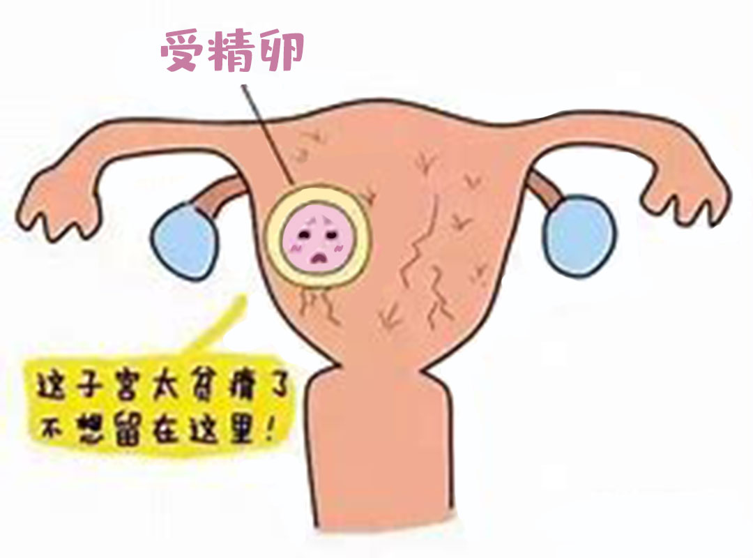 洪芙蓉医师|子宫内膜薄怎么办？学会这几招，好孕挡不住！