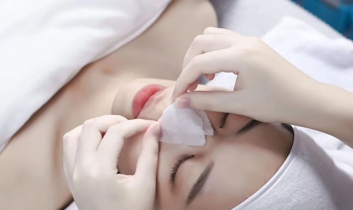 黑头|黑头没救了,别瞎说!