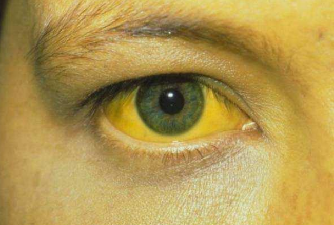 肝脏|解毒的“高手”公布，并非菊花，平时敞开吃，排出肝毒，肝脏红润更强壮