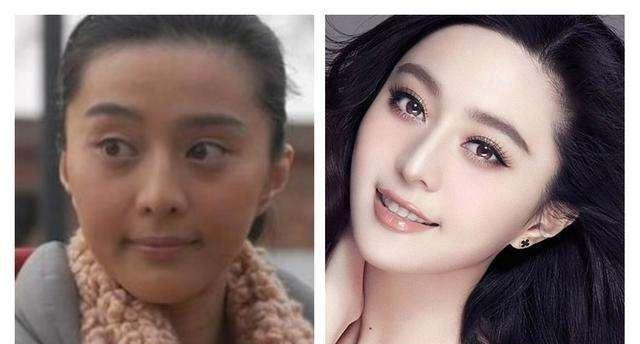 好物官|杭州女子为变美，自己注射“美白针”，结果“高烧不退”