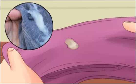 静东堂|25岁女子检查发现hpv,医生:身体若有这2变化,或跟hpv有关