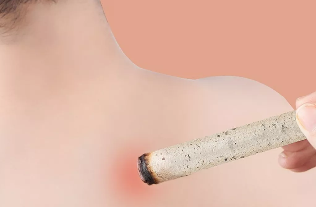 宫廷晟方 艾灸---女人的第二春