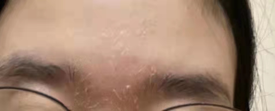 冬季护肤 冬季肌肤问题层出不穷？宝典在手，远离沙漠肌养成水光肌并不难！！
